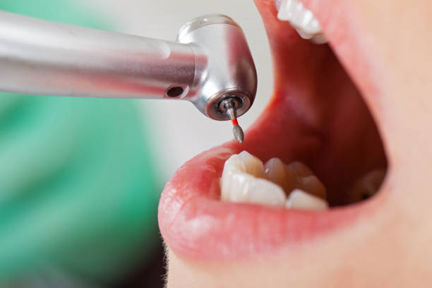 Best Emergency Dental Care for Broken or Chipped Teeth in Sauk City, WI